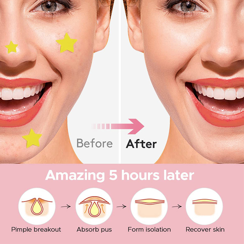 600 ピース/セットスターにきびパッチにきびカラフルな目に - Makeup And Beauty のレビューと価格